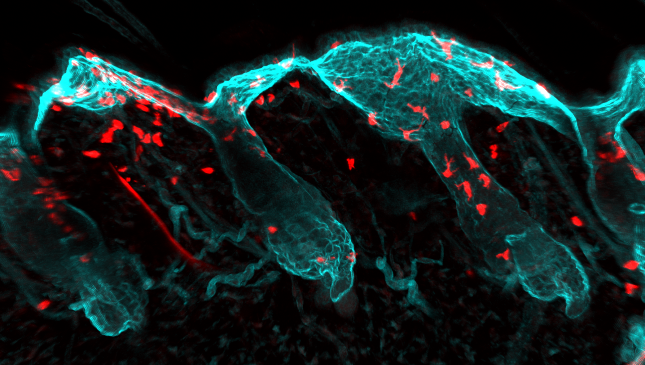 Epithelia CD49F